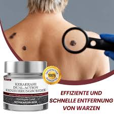 Wart-Free Skin Made Simple: A Safe and Effective Solution for Clear, Smooth Results.